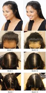 All i want to do is thin their hair out occasionally because their hair is so long and way too thick. 13 Hair Loss Causes Ideas Hair Loss Hair Loss Causes Hair