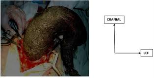 Image result for Pica