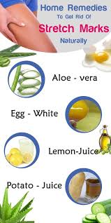 Safe And Effective Remedies To Get Rid Of Stretch Marks Naturally Stretch Mark Remedies Stretch Marks Dry Skin Remedies