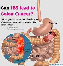 Diarrhea, even weird looking, is a common symptom in the mass of population, though it can be caused by colon cancer. Can Ibs Lead To Colon Cancer