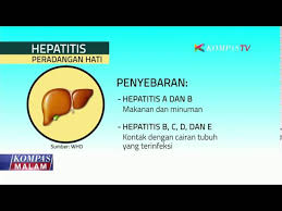 Penyakit hepatitis e boleh disebarkan menerusi tikus. Apa Itu Penyakit Hepatitis Youtube