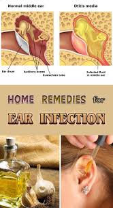 Home Remedies For Ear Infection Ear Infection Remedy Ear Infection Ear Infection Home Remedies