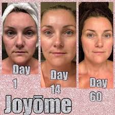 Health benefits of collagen 🔥 ✍️It gives skin Glow ✍️ Fight constipation  ✍️ Strong muscle and bones ✍️ Reduce wrinkles ✍️ Tighten 🍑 ✍️ Fight  infection And many more...