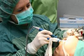Clinica laser vision med este dotata cu cea mai noua generatie a laserului cu excimer alcon wave light. Aparatul Care Topeste Amigdalele FÄƒrÄƒ Durere Evenimentul Zilei