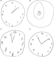 Image result for Clock Drawing Test