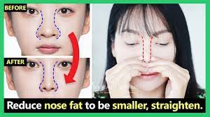 Where sharp and perfectly shaped nose looks attractive, fat and broad nose becomes source of embarrassment for many people. How To Reduce Big Nose Size Nose Fat To Small Slim Straight Natural New Techniques Best Results Youtube