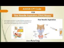 Ct Guided Lung Biopsy Cpt Code 07 2021