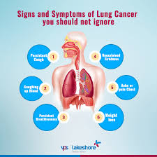 Signs and symptoms of lung cancer typically occur when the disease is advanced. Facebook