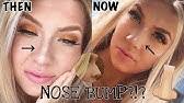 I had a big nose with a bump at the top of the bridge, and i to understand the magnitude of how good this powder is, you have to understand how much i loathed. The Nose Job Nose Contour How To Contour A Big Crooked Nose Youtube