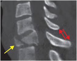 We did not find results for: Axial Skeleton Trauma Section 9 1 Emergency Radiology Coffee Case Book