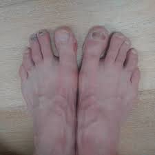 Piers morgan had a twitter spat with beverley turner after she said she wouldn't be clapping for captain sir tom moore. Bev Turner On Twitter Good For Your Feet This Marathon Running Jamescracknell S Battered Size 13s After 2hr50run Marathon Http T Co Sw0txjyt6r