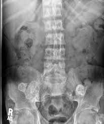 Pin On X Ray