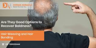 There are 2 solutions for hair replacement they are hair weaving and hair transplantation. Hair Weaving And Hair Bonding Are They Good Options To Recover Baldness