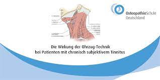 Tinnitus kommt aus dem lateinischen „tinnire und steht für klingeln, klimpern oder schellen. Die Wirkung Der Ohrzug Technik Bei Patienten Mit Chronisch Subjektivem Tinnitus Osteopathie Schule Deutschland