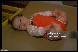 Image result for chernobyl fukushima children mutations