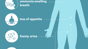 Acute renal failure are classified into following: Kidney Disease Signs And Symptoms