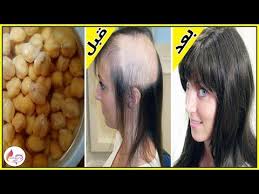 كنز رباني عظيم لن يتوقف شعرك عن النمو بغزارة دون توقف ولن يتساقط بعد اليوم ينبت الفراغات Youtube Beautiful Hair Hair Beauty