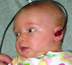 The newborn hearing screening