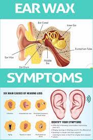 Best Home Remedies For Ear Wax Blockage Removal Ear Wax Impacted Ear Wax Impacted Ears