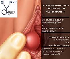 Intraabdominal infection, pelvic inflammatory disease, ceftriaxone, antibiotics, cyst. What Is Bartholin Cyst Hello Ladies Nurse Olayemi Adeola Facebook