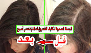 تكثيف الشعر وإنبات الفراغات بوصفة معجزة فى أسبوع واحد فقط وداعا للصلع ثقفني