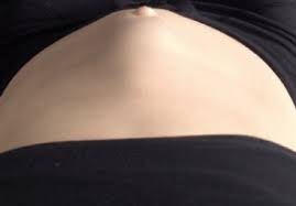 If you have diastasis recti, steer clear of ab work that requires you to hold certain positions for a long time, especially against gravity. Diastsis Recti A Guide To Separated Abdominal Muscles Moms Into Fitness