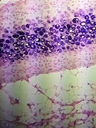 Hyaline Cartilage Under A Microscope Hyaline Cartilage Histology Slides Things Under A Microscope