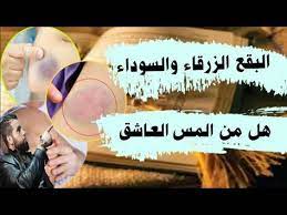 ظهور بقع زرقاء هل من المس اوا الجن العاشق youtube youtube movie posters content