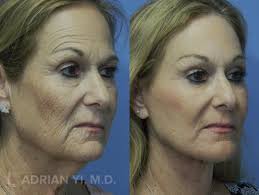 Adrian Yi, M.D.Plastic Surgery (@dr.adrianyi) • Instagram photos and videos