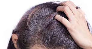 The first and foremost is an unbalanced diet. How To Get Rid Of White Hair Follow These Remedies Credihealth