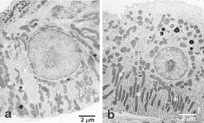 Electron micrograph of one mitochondrion within a mouse liver cell (hepatocyte). Electron Microscopy Of Striated Duct Cells Of The Submandibular Gland Download Scientific Diagram