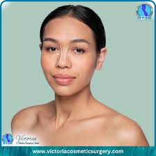 The Meraki Nose— where redefined confidence begins. At Meraki Esthetique,  we nurture self-love by enhancing your natural beauty with personalized  attention and care, helping you feel your best, inside and out. Ready