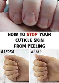 Allyoucando Info Nbspallyoucando Resources And Information Cuticle Repair How To Grow Nails Peeling Cuticles
