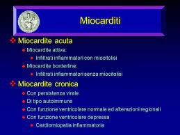 Miocardita acută virală la copil. Qr Code Miocarditi Miocardite Acuta Miocardite Attiva Infiltrati Infiammatori Con Miocitolisi Infiltrati Infiammatori Con Miocitolisi Miocardite Ppt Download