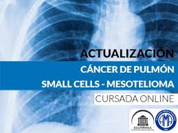 Malignant pleural mesothelioma forms within the protective tissue lining that covers the lungs and chest, called the pleura.it is the most common type of mesothelioma and accounts for around 80% of cases. Cancer De Pulmon Small Cells Y Mesotelioma Eduvirama