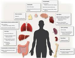Surviving sepsis campaign guidelines committee including the pediatric subgroup. Frontiers Sepsis Inflammation Is A Necessary Evil Cell And Developmental Biology