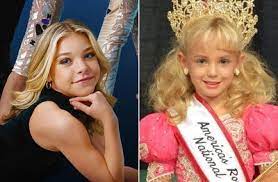 JonBenet Ramsey