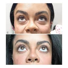 Vanessa Cichon, AGACNP, FNP