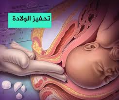طرق تحفيز الولادة تحريض الولادة الحامل الحمل والولادة