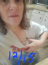 What advice is there for healing after sleep apnea surgery?