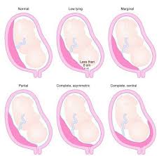 Pin On Sonografia