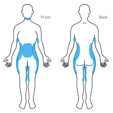 Located between each of the vertebra in the spinal column, discs act as shock absorbers for the spinal bones. Coolsculpting Body Contouring Non Invasive Fat Reduction Fat Freezing Cedar Grove Nj Nj Health Hub