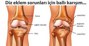 Eklem Ve Diz Agrilari Icin Muhtesem Karisim Saglik Saglik Urunleri Saglik Ipuclari