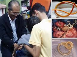Cara makan ubat cacing untuk yang aslah sudah hampir melangkah umur 4 tahun. Jangkitan Cacing Boleh Akibatkan Anemia Ganggu Tumbesaran Anak Mak Mak Mohon Bagi Ubat Cacing Ikut Waktu Mingguan Wanita
