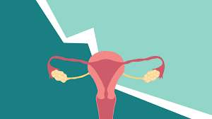 the 4 stages of endometriosis and what each one means health