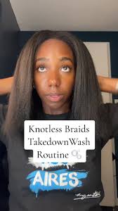 Seborrheic Dermatitis Natural Hair