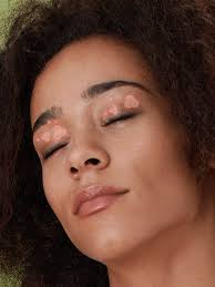 Get free best concealer for dark eyelids now and use best concealer for dark eyelids immediately to get % off or $ off or free shipping. Eyelid Eczema Here S Exactly How To Treat It Self