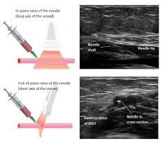 Image result for IV Access