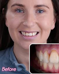 Elit Dental Clinic Kusadasi