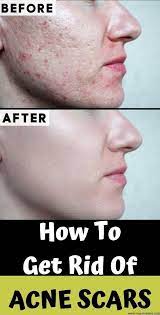 Pin On Homemade Spa Treatments